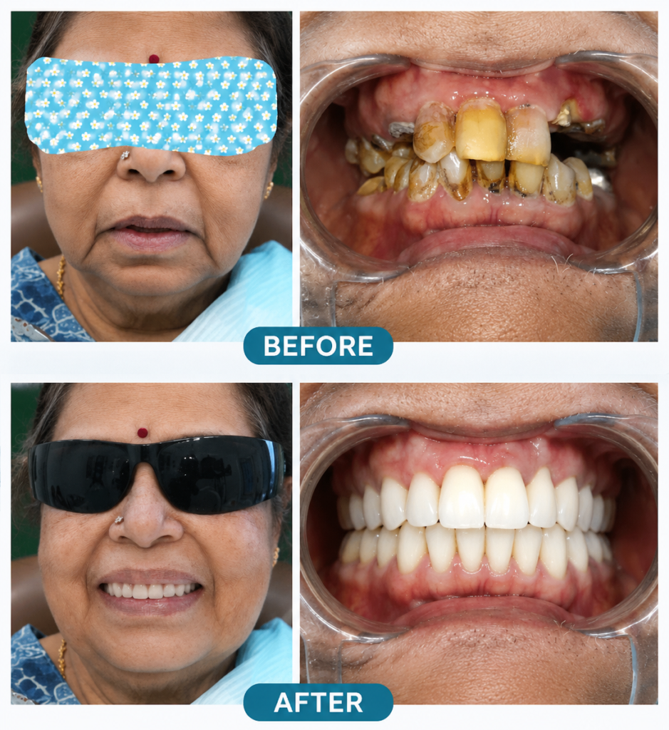 before after Image